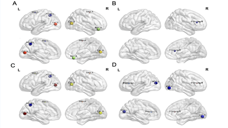 【科研前沿】上海精卫成瘾医学团队研究成果发表于Drug and Alcohol Dependence
